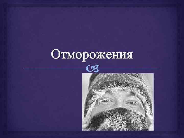 Отморожения 