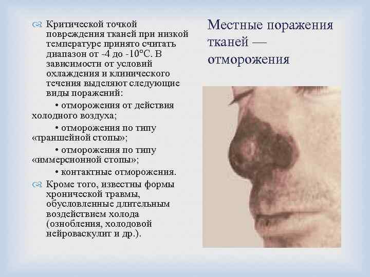  Критической точкой повреждения тканей при низкой температуре принято считать диапазон от -4 до