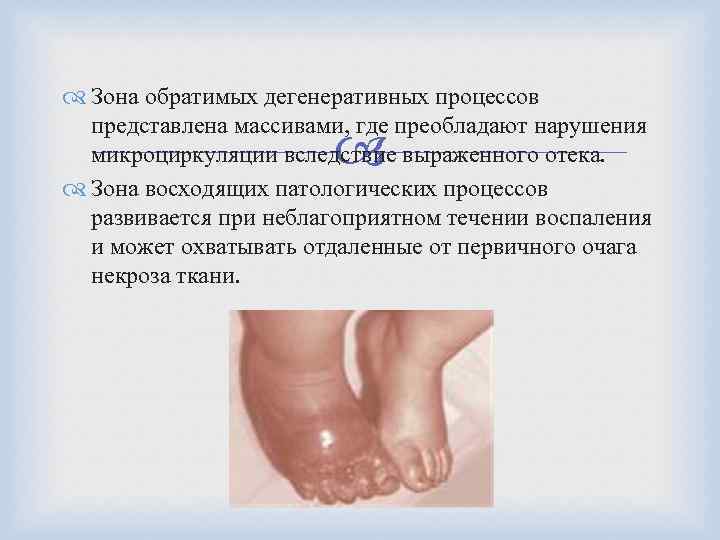  Зона обратимых дегенеративных процессов представлена массивами, где преобладают нарушения микроциркуляции вследствие выраженного отека.