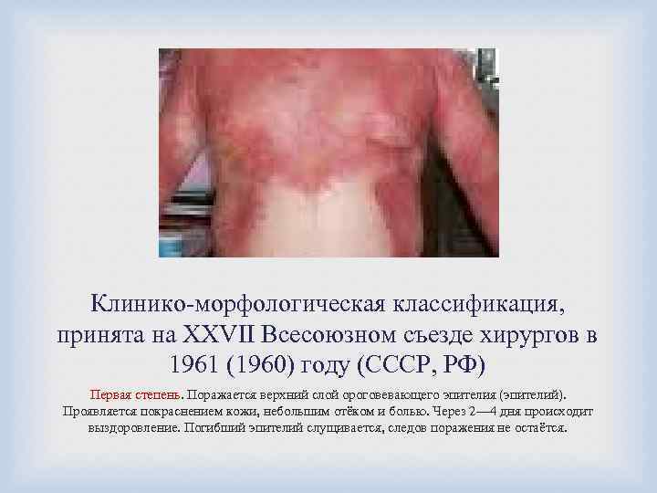 Клинико-морфологическая классификация, принята на XXVII Всесоюзном съезде хирургов в 1961 (1960) году (СССР, РФ)