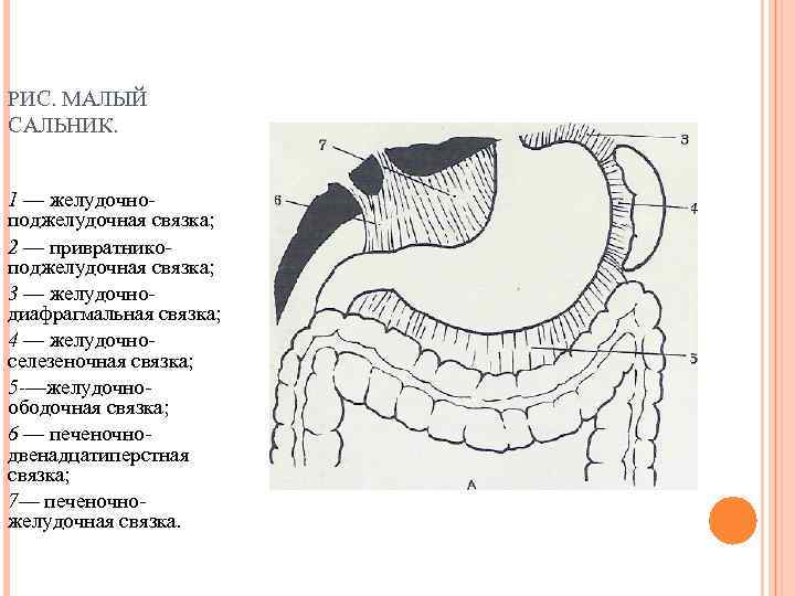 РИС. МАЛЫЙ САЛЬНИК. 1 — желудочноподжелудочная связка; 2 — привратникоподжелудочная связка; 3 — желудочнодиафрагмальная
