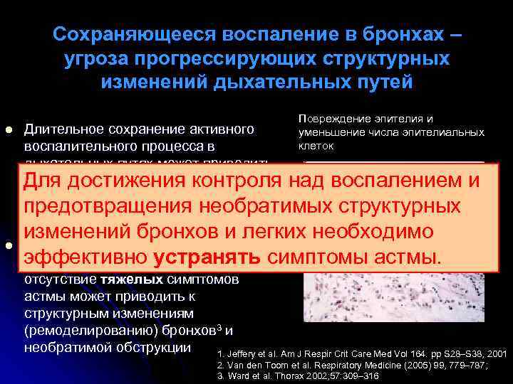Сохраняющееся воспаление в бронхах – угроза прогрессирующих структурных изменений дыхательных путей l l Повреждение
