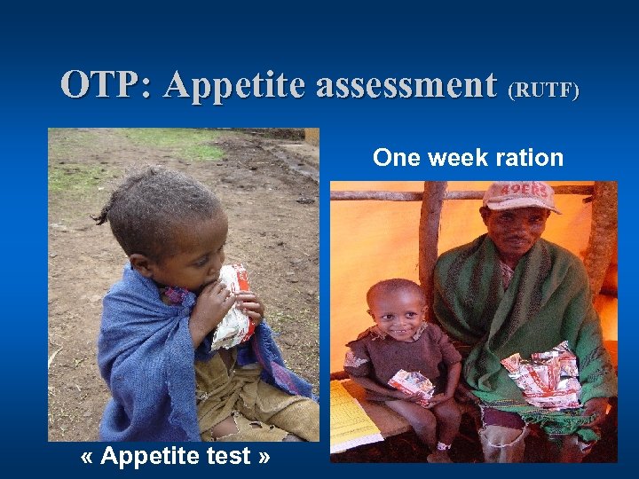 OTP: Appetite assessment (RUTF) One week ration « Appetite test » 