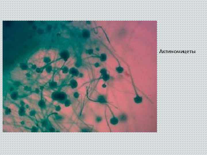 Актиномицеты 