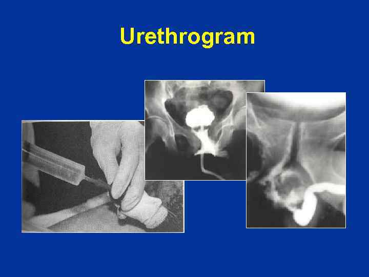 Urethrogram 