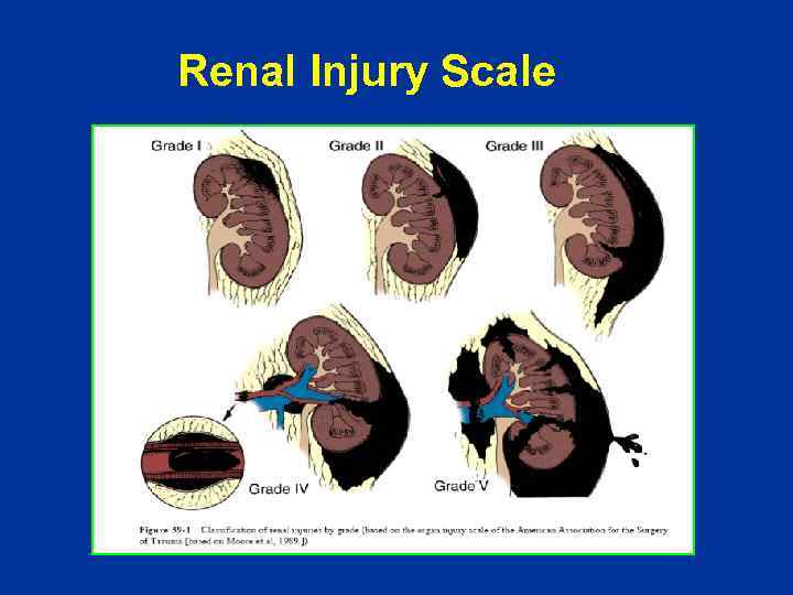 Renal Injury Scale 