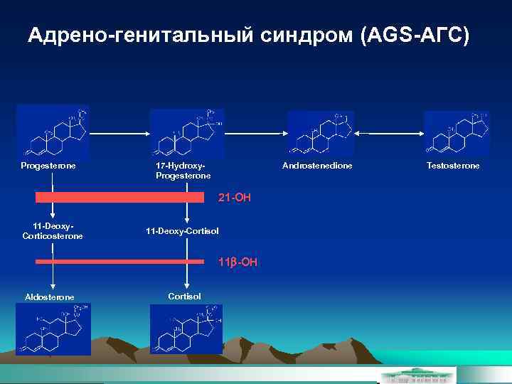 Адрено-генитальный синдром (AGS-АГС) Progesterone Androstenedione 17 -Hydroxy. Progesterone 21 -OH 11 -Deoxy. Corticosterone 11