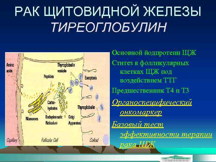 РАК ЩИТОВИДНОЙ ЖЕЛЕЗЫ ТИРЕОГЛОБУЛИН Основной йодпротеин ЩЖ Стнтез в фолликулярных клетках ЩЖ под воздействием