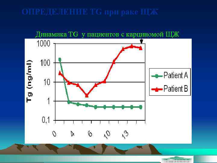 ОПРЕДЕЛЕНИЕ TG при раке ЩЖ Динамика TG у пациентов с карциномой ЩЖ 