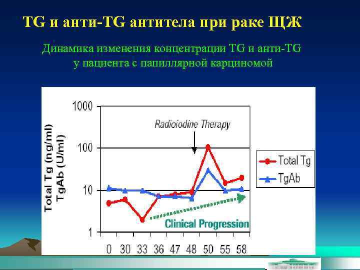 TG и анти-TG антитела при раке ЩЖ Динамика изменения концентрации TG и анти-TG у