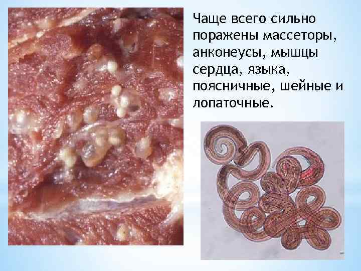 Чаще всего сильно поражены массеторы, анконеусы, мышцы сердца, языка, поясничные, шейные и лопаточные. 