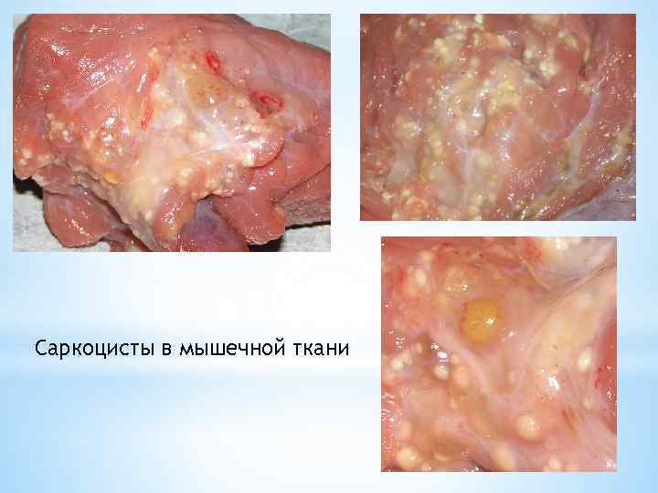 Саркоцисты в мышечной ткани 