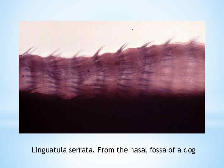 Linguatula serrata. From the nasal fossa of a dog 