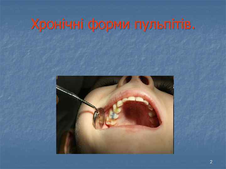 Хронічні форми пульпітів. 2 