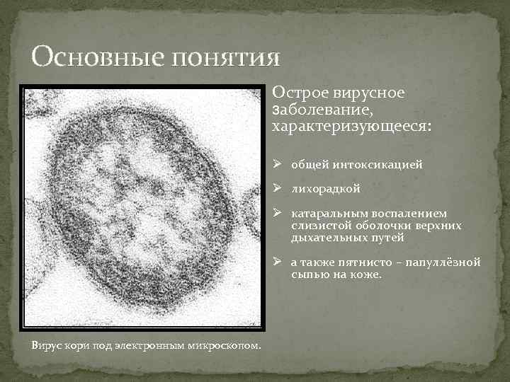 Основные понятия Острое вирусное заболевание, характеризующееся: Ø общей интоксикацией Ø лихорадкой Ø катаральным воспалением