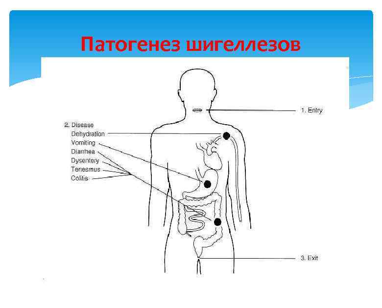 Патогенез шигеллезов 