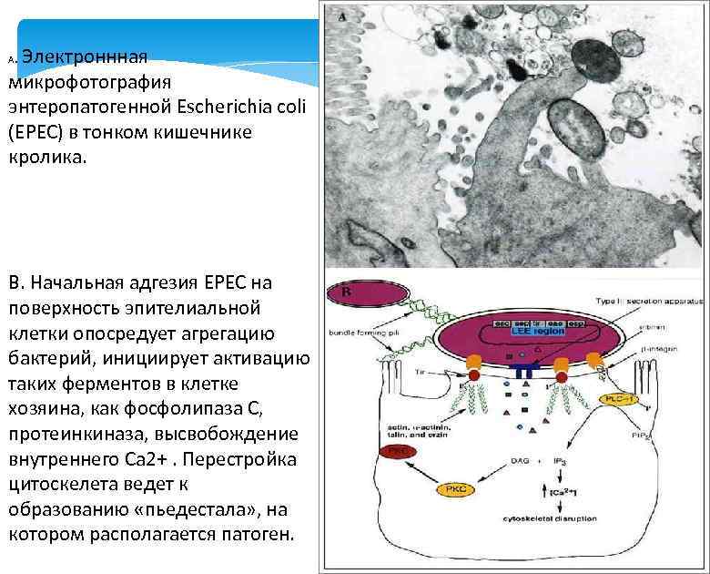 A . Электроннная микрофотография энтеропатогенной Escherichia coli (EPEC) в тонком кишечнике кролика. B. Начальная