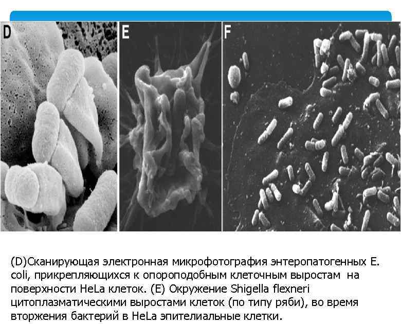 (D)Сканирующая электронная микрофотография энтеропатогенных Е. coli, прикрепляющихся к опороподобным клеточным выростам на поверхности He.