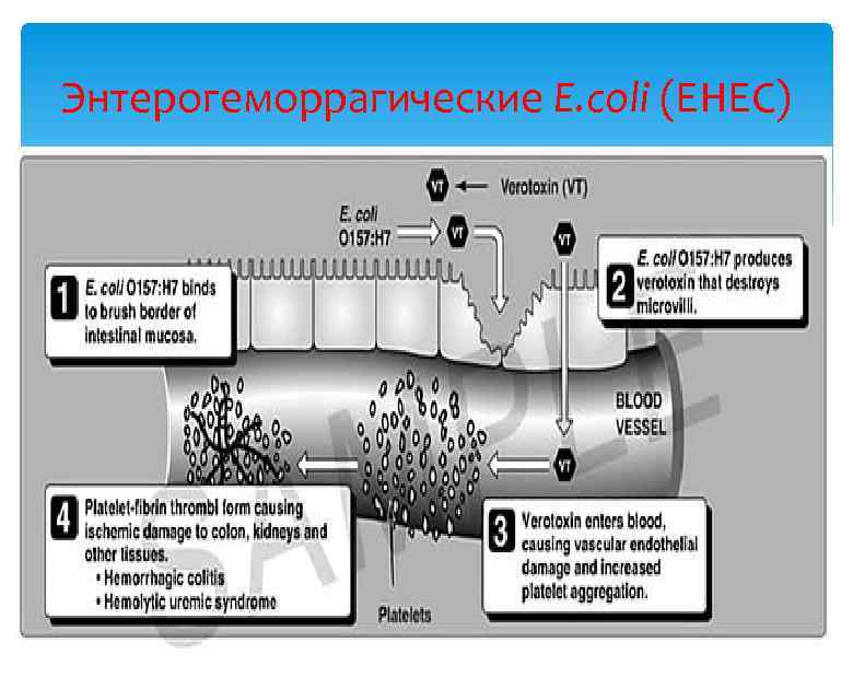 Энтерогеморрагические E. coli (EHEC) 