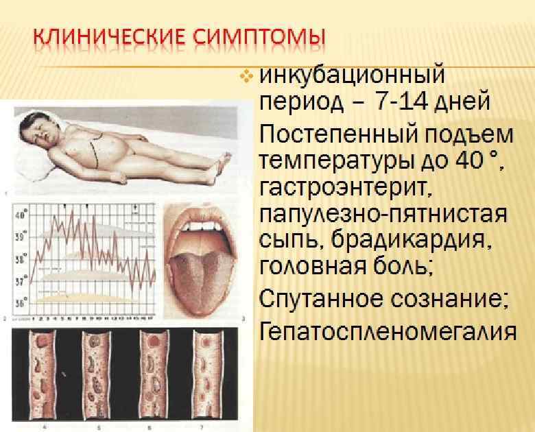 Клинические симптомы v инкубационный период – 7 -14 дней v. Постепенный подъем температуры до