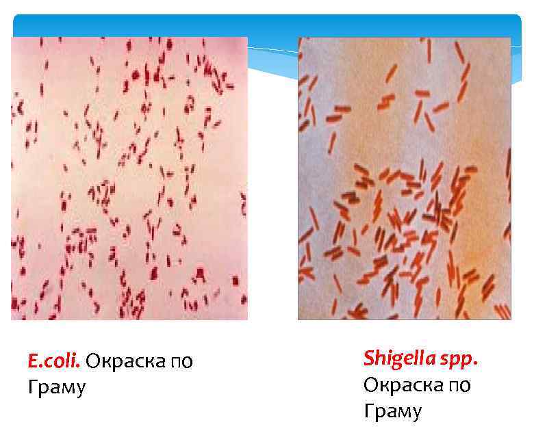 E. coli. Окраска по Граму Shigella spp. Окраска по Граму 