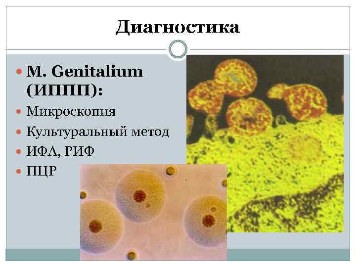 Chlamydia trachomatis mycoplasma genitalium. Урогенитальный микоплазмоз. Возбудитель уреаплазмоза. Урогенитальные инфекции и ИППП. Лабораторная диагностика урогенитального микоплазмоза.