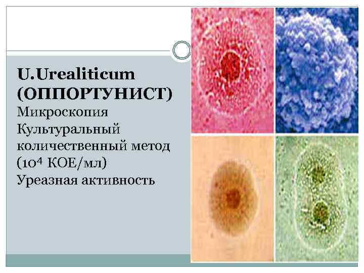 U. Urealiticum (ОППОРТУНИСТ) Микроскопия Культуральный количественный метод (10⁴ КОЕ/мл) Уреазная активность 