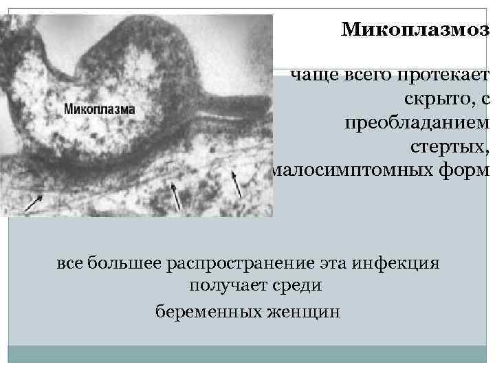 Микоплазмоз чаще всего протекает скрыто, с преобладанием стертых, малосимптомных форм все большее распространение эта