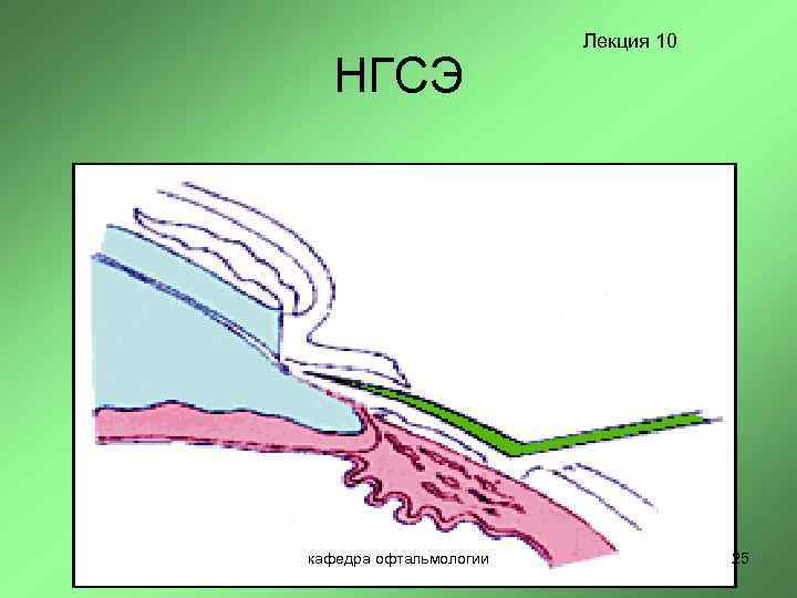НГСЭ кафедра офтальмологии Лекция 10 25 