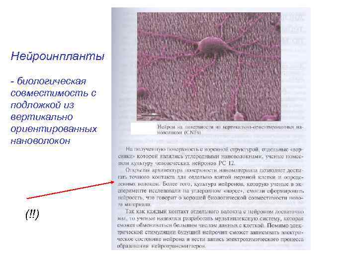 Нейроинпланты - биологическая совместимость с подложкой из вертикально ориентированных нановолокон (!!) 