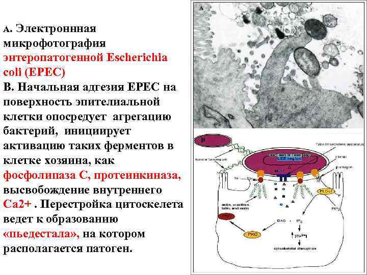 A. Электроннная микрофотография энтеропатогенной Escherichia coli (EPEC) B. Начальная адгезия EPEC на поверхность эпителиальной