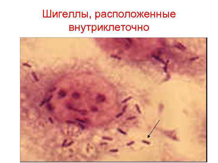 Шигеллы, расположенные внутриклеточно 