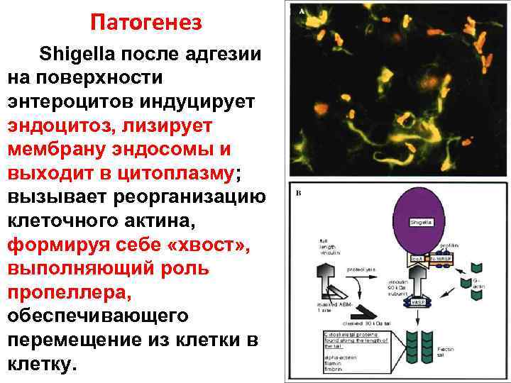 Патогенез Shigella после адгезии на поверхности энтероцитов индуцирует эндоцитоз, лизирует мембрану эндосомы и выходит