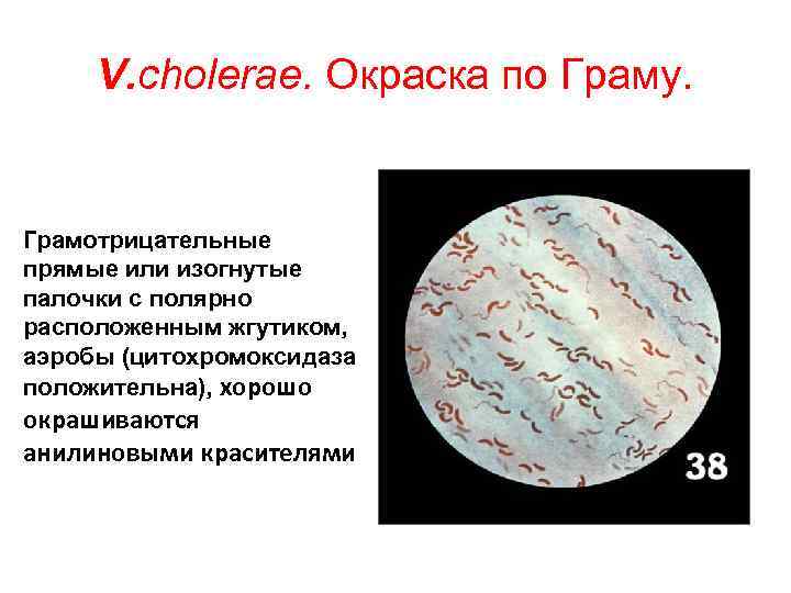 V. cholerae. Окраска по Граму. Грамотрицательные прямые или изогнутые палочки с полярно расположенным жгутиком,