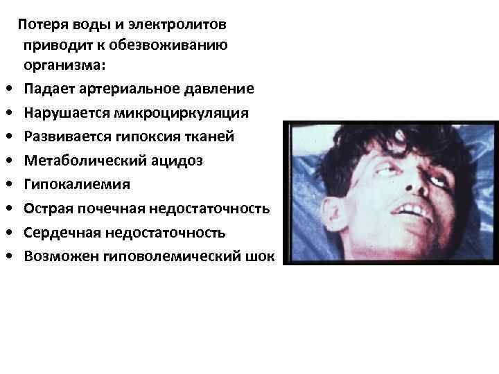 Потеря воды и электролитов приводит к обезвоживанию организма: • Падает артериальное давление • Нарушается