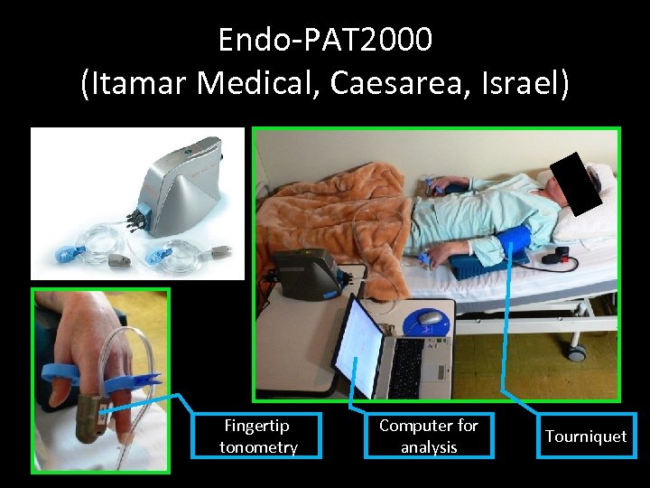 Endo-PAT 2000 (Itamar Medical, Caesarea, Israel) Fingertip tonometry Computer for analysis Tourniquet 