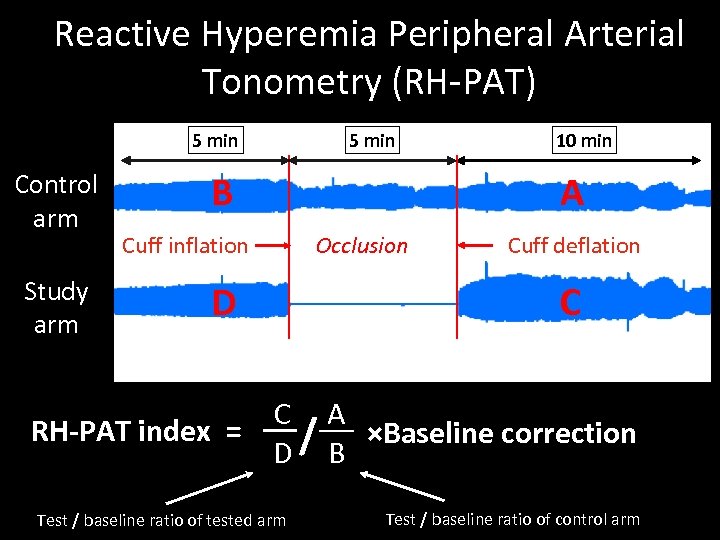 Reactive Hyperemia Peripheral Arterial Tonometry (RH-PAT) 5 min Control arm Study arm 5 min