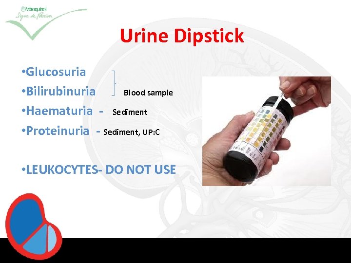 Urine Dipstick • Glucosuria • Bilirubinuria Blood sample • Haematuria - Sediment • Proteinuria