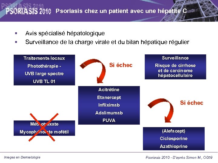 Psoriasis chez un patient avec une hépatite C Avis spécialisé hépatologique Surveillance de la