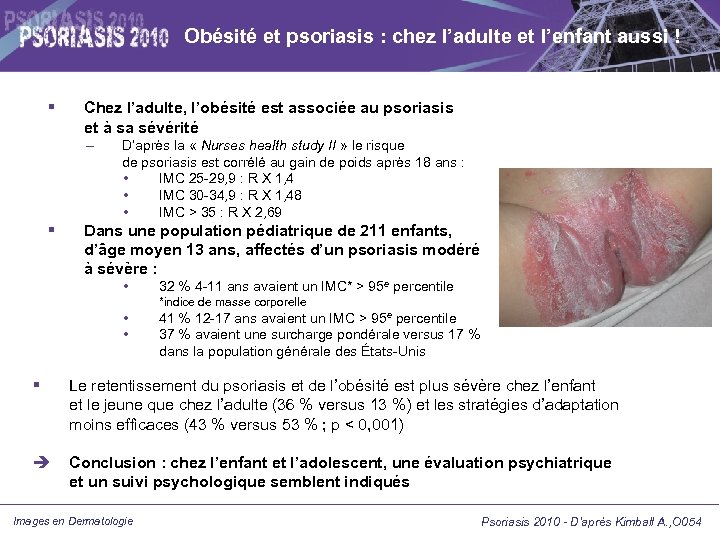 Obésité et psoriasis : chez l’adulte et l’enfant aussi ! Chez l’adulte, l’obésité est