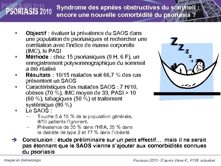 Syndrome des apnées obstructives du sommeil : encore une nouvelle comorbidité du psoriasis ?