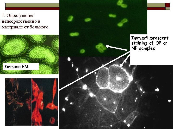 1. Определение непосредственно в материале от больного Immuofluorescent staining of OP or NP samples
