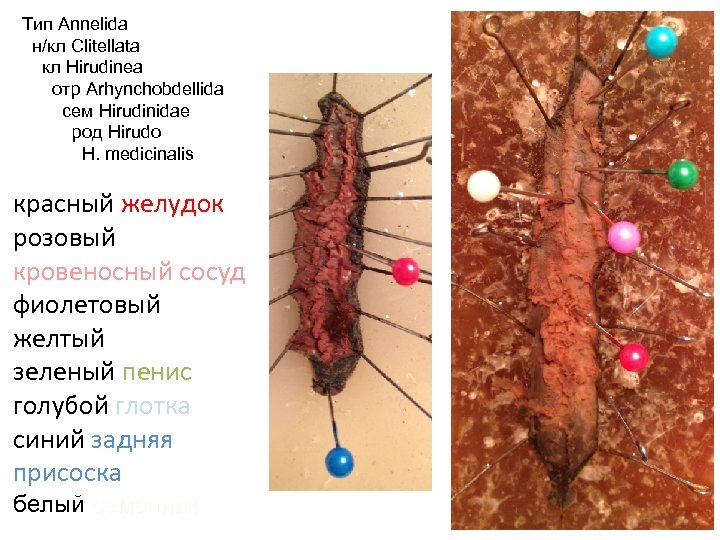 Тип Annelida н/кл Clitellata кл Hirudinea отр Arhynchobdellida сем Hirudinidae род Hirudo H. medicinalis