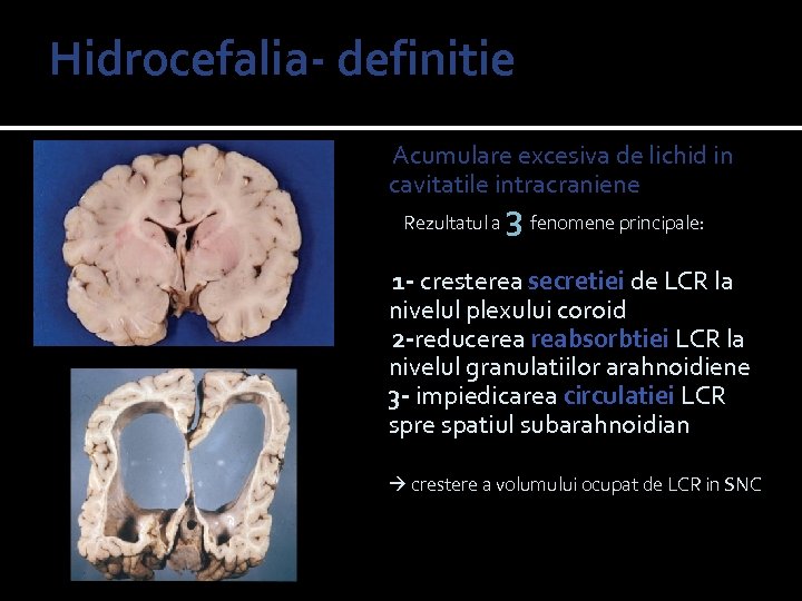 Hidrocefalia- definitie hydro= apa cephalus= cap Acumulare excesiva de lichid in cavitatile intracraniene Rezultatul