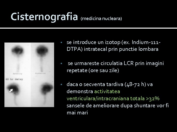 Cisternografia (medicina nucleara) • se introduce un izotop (ex. Indium-111 DTPA) intratecal prin punctie