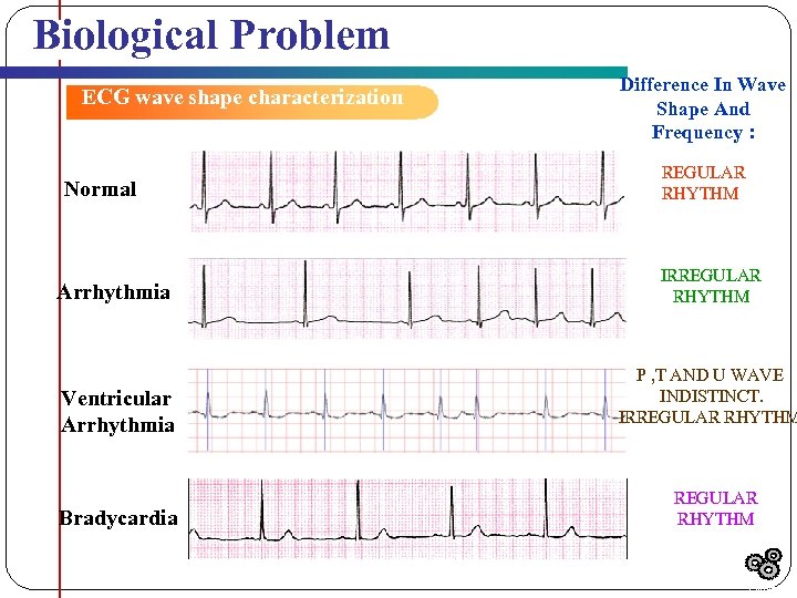 Biological Problem ECG wave shape characterization Normal Arrhythmia Ventricular Arrhythmia Bradycardia Difference In Wave