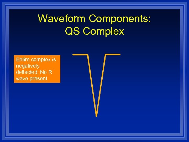 Waveform Components: QS Complex Entire complex is negatively deflected; No R wave present 
