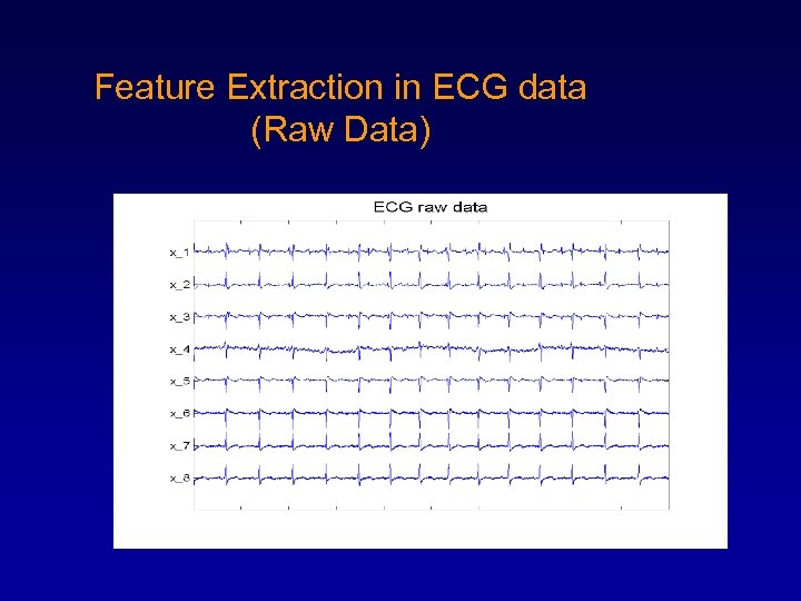 Feature Extraction in ECG data (Raw Data) 