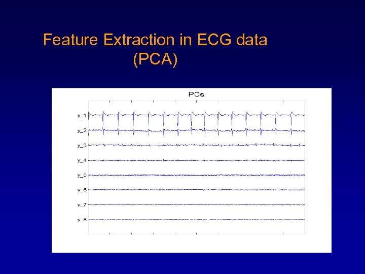 Feature Extraction in ECG data (PCA) 