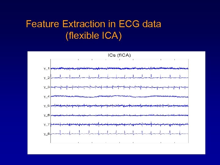 Feature Extraction in ECG data (flexible ICA) 